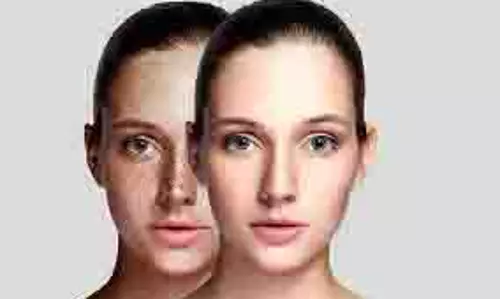 Home Remedies: इन घरेलू नुस्खों से करें चेहरे के दाग-धब्बों का इलाज