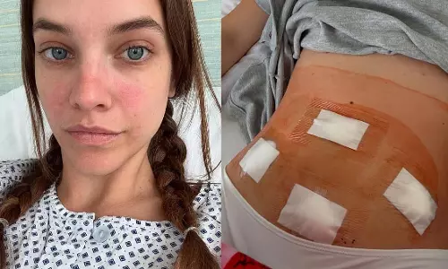 Barbara Palvin: एंडोमेट्रियोसिस सर्जरी के दर्दनाक अनुभव को किया साझा