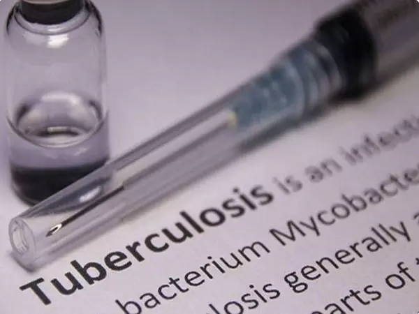 WHO ने TB से निपटने में पोषण की भूमिका पर ICMR के अध्ययन की सराहना की WHO ने TB से निपटने में पोषण की भूमिका पर ICMR के अध्ययन की सराहना की