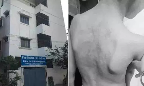 एक किताब मांगने पर दूसरी देने पर शिक्षक ने पहली कक्षा के छात्र पर हमला किया