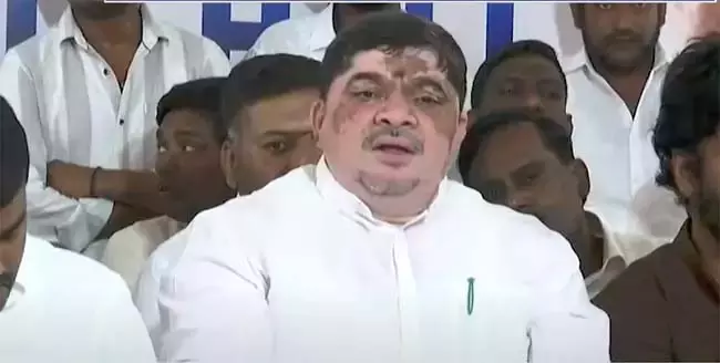 उर्वरकों की आपूर्ति की जिम्मेदारी केंद्र की है: Ponnam Prabhakar उर्वरकों की आपूर्ति की जिम्मेदारी केंद्र की है: Ponnam Prabhakar
