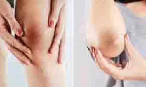 Skin Care Tips: घुटनों का कालापन हटाएं, इस्तेमाल करें ये नुस्खे