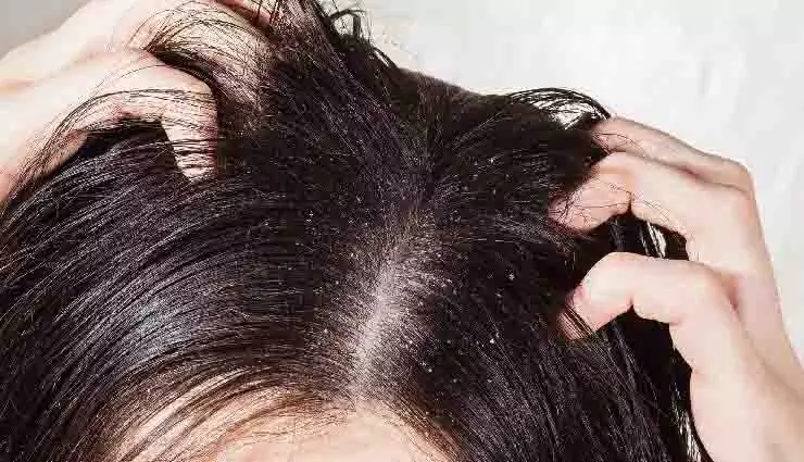 Hair care: रूखे स्कैल्प और तैलीय बालों के इलाज के DIY तरीके Hair care: रूखे स्कैल्प और तैलीय बालों के इलाज के DIY तरीके