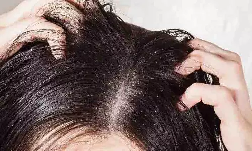 Hair care: रूखे स्कैल्प और तैलीय बालों के इलाज के DIY तरीके Hair care: रूखे स्कैल्प और तैलीय बालों के इलाज के DIY तरीके