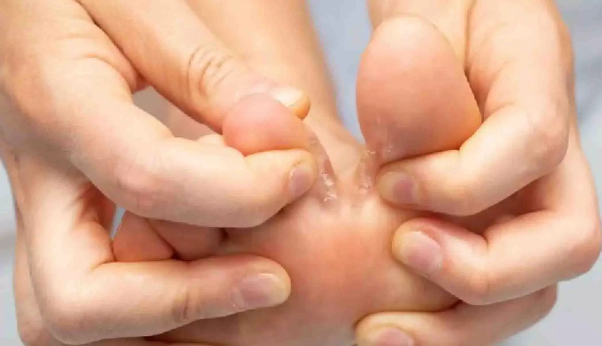 Health: पैरों के तलवों पर एसेंशियल ऑयल लगाने के अद्भुत फायदे Health: पैरों के तलवों पर एसेंशियल ऑयल लगाने के अद्भुत फायदे