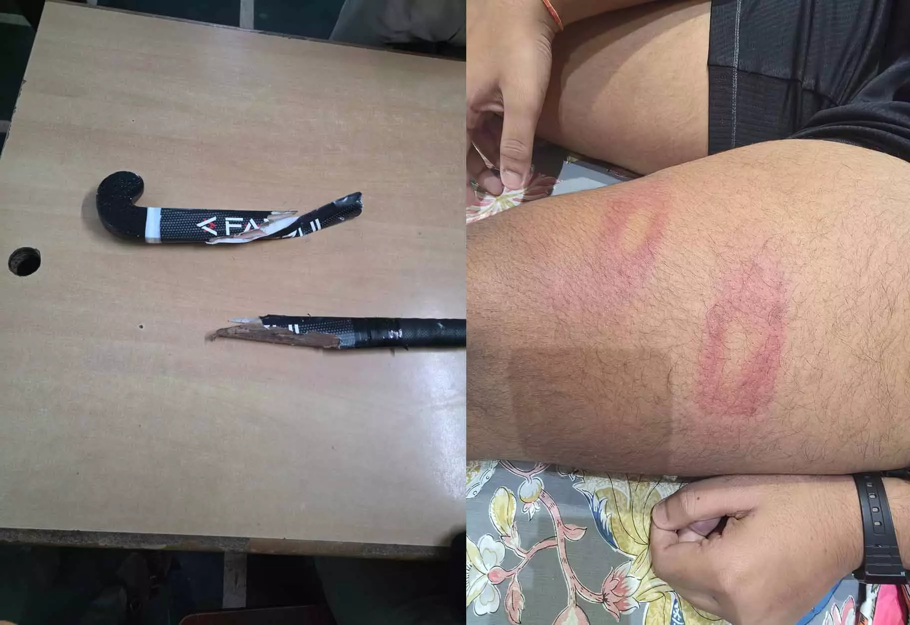 तेलीबांधा में सड़क पर खौफनाक वारदात, मामूली वाहन टच पर युवक को मारने की कोशिश तेलीबांधा में सड़क पर खौफनाक वारदात, मामूली वाहन टच पर युवक को मारने की कोशिश
