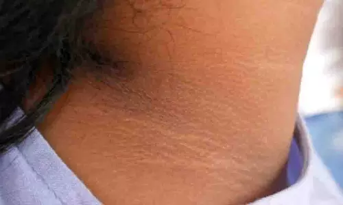 Beauty Tips: गर्दन का कालापन दूर करने के आसान घरेलू उपाय, तुरंत दिखेगा फायदा Beauty Tips: गर्दन का कालापन दूर करने के आसान घरेलू उपाय, तुरंत दिखेगा फायदा