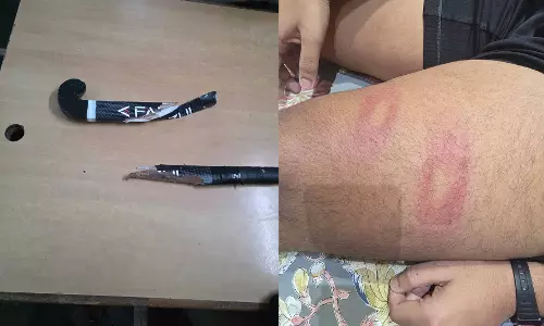 तेलीबांधा में सड़क पर खौफनाक वारदात, मामूली वाहन टच पर युवक को मारने की कोशिश