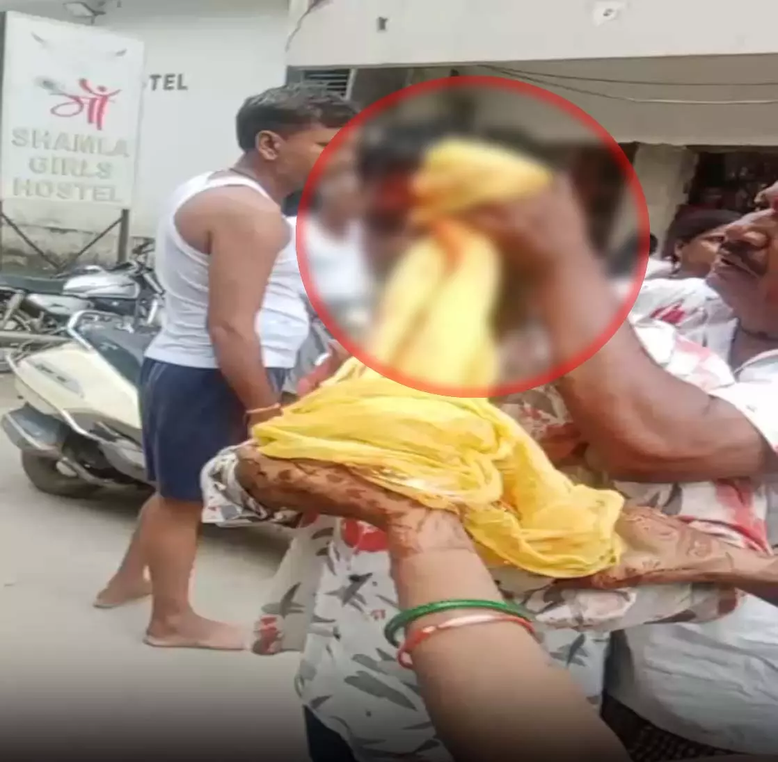 आवारा कुत्ते के विवाद में हाथ के कडे से किया युवक पर हमला, वीडियो वायरल आवारा कुत्ते के विवाद में हाथ के कडे से किया युवक पर हमला, वीडियो वायरल