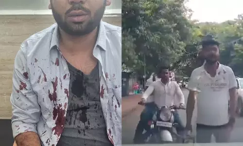 Pune : खड़की में गलत साइड से बाइक चला रहे व्यक्ति को रोकने पर कार चालक पर हमला Pune : खड़की में गलत साइड से बाइक चला रहे व्यक्ति को रोकने पर कार चालक पर हमला