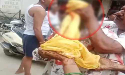 आवारा कुत्ते के विवाद में हाथ के कडे से किया युवक पर हमला, वीडियो वायरल आवारा कुत्ते के विवाद में हाथ के कडे से किया युवक पर हमला, वीडियो वायरल