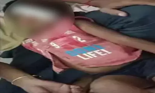 कुत्तों ने फिर किया हमला, तीन बच्चों को बनाया निशाना कुत्तों ने फिर किया हमला, तीन बच्चों को बनाया निशाना