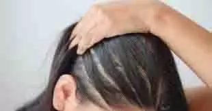 Hair Care: मानसून में झड़ते बालों को कैसे रोकें, ये टिप्स आएंगे आपके काम Hair Care: मानसून में झड़ते बालों को कैसे रोकें, ये टिप्स आएंगे आपके काम