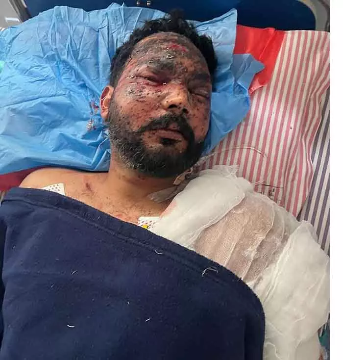 IED विस्फोट में कांस्टेबल घायल, अमृतसर पुलिस ने स्वीकार किया IED विस्फोट में कांस्टेबल घायल, अमृतसर पुलिस ने स्वीकार किया