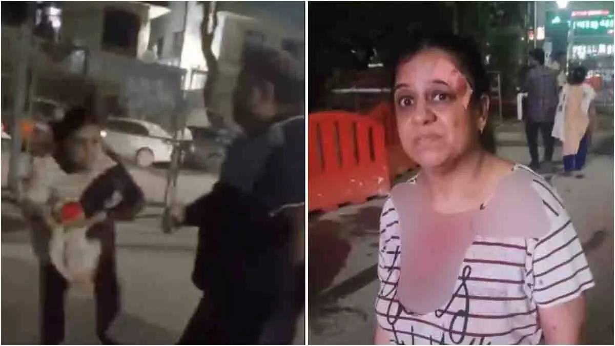 Delhi: बुजुर्ग कुत्ते को खाना खिलाना पड़ा भारी, वकील ने की बर्बर पिटाई Delhi: बुजुर्ग कुत्ते को खाना खिलाना पड़ा भारी, वकील ने की बर्बर पिटाई