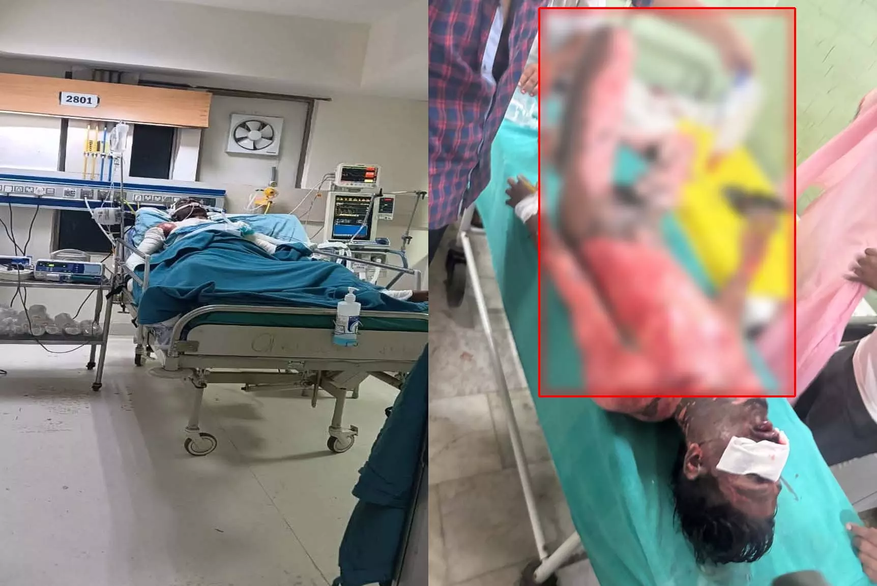 रेलवे कोचिंग यार्ड हादसा, करंट से झुलसे ठेकाकर्मी की मौत रेलवे कोचिंग यार्ड हादसा, करंट से झुलसे ठेकाकर्मी की मौत