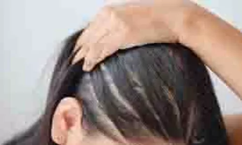 Hair Care: मानसून में झड़ते बालों को कैसे रोकें, ये टिप्स आएंगे आपके काम