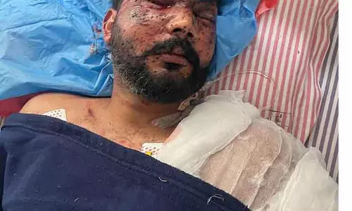 IED विस्फोट में कांस्टेबल घायल, अमृतसर पुलिस ने स्वीकार किया