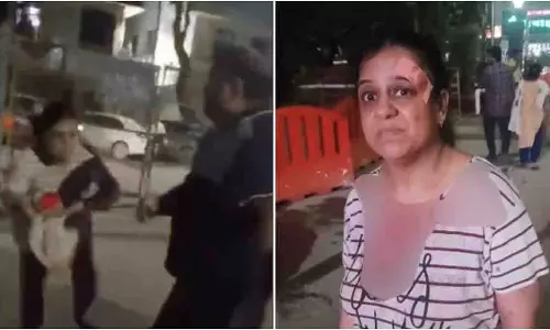 Delhi: बुजुर्ग कुत्ते को खाना खिलाना पड़ा भारी, वकील ने की बर्बर पिटाई