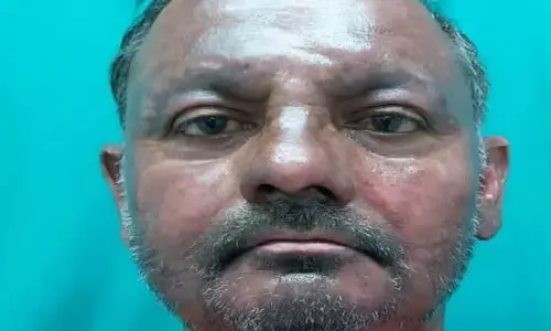 Nagaland के इलेक्ट्रीशियन की गंभीर जलने की चोट के बाद सेना की देखरेख में उल्लेखनीय सुधार Nagaland के इलेक्ट्रीशियन की गंभीर जलने की चोट के बाद सेना की देखरेख में उल्लेखनीय सुधार