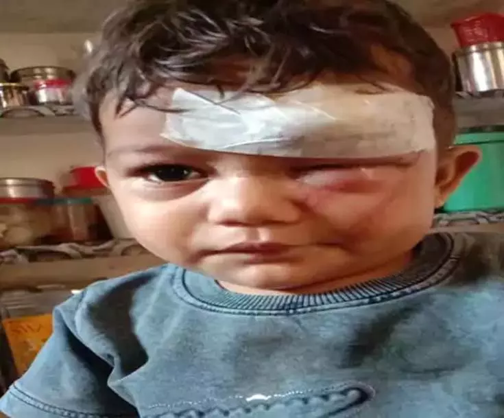 बैलों की भिड़ंत से मचा हड़कंप, 13 महीने का मासूम समेत चार लोग घायल बैलों की भिड़ंत से मचा हड़कंप, 13 महीने का मासूम समेत चार लोग घायल