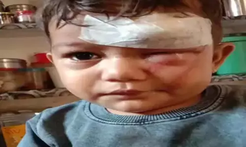 बैलों की भिड़ंत से मचा हड़कंप, 13 महीने का मासूम समेत चार लोग घायल