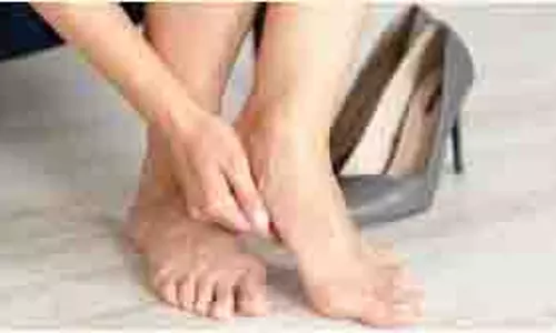 Skin care: रूखी और फटी एड़ियों से छुटकारा पाने के लिए आज से ही अपनाएं ये टिप्स Skin care: रूखी और फटी एड़ियों से छुटकारा पाने के लिए आज से ही अपनाएं ये टिप्स
