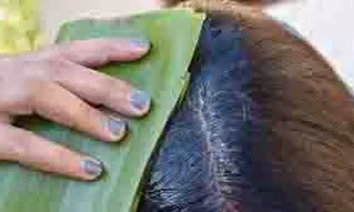 hair Care:एलोवेरा से दूर होंगी बालों की समस्याएं, इस्तेमाल करें ये हेयर मास्क hair Care:एलोवेरा से दूर होंगी बालों की समस्याएं, इस्तेमाल करें ये हेयर मास्क