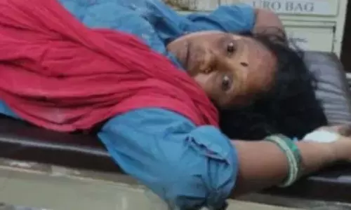 ईंट मशीन की चपेट में आई महिला, पैर फैक्चर