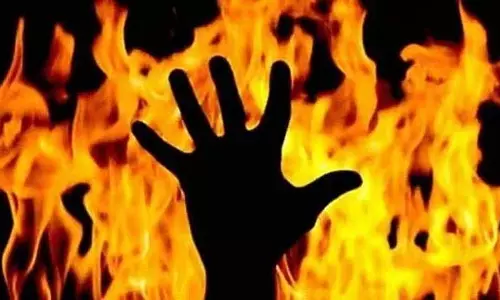 Bengaluru : कैब ड्राइवर ने पूर्व प्रेमिका पर पेट्रोल डालकर आग लगा दी