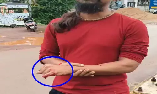 उंगली काटा जताया विरोध, गौरक्षक ने अपनी उंगली काटकर दी कुर्बानी