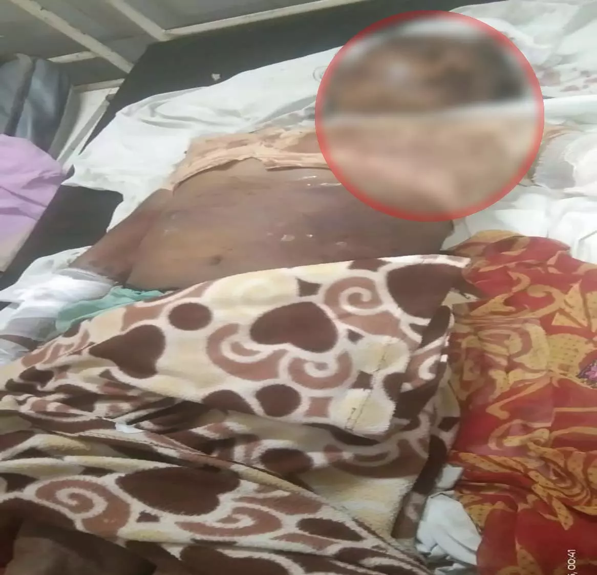 नशेड़ी युवक ने नानी की हत्या की, पुलिस ने आरोपी को किया गिरफ्तार नशेड़ी युवक ने नानी की हत्या की, पुलिस ने आरोपी को किया गिरफ्तार