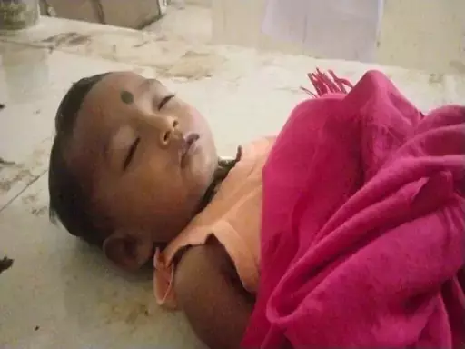 बच्चे के गले में चना अटका, मौत बच्चे के गले में चना अटका, मौत