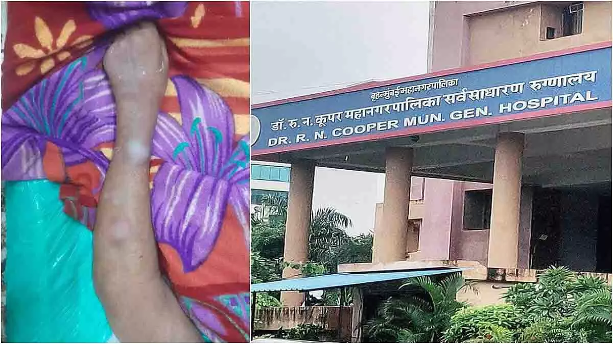 Mumbai: कूपर अस्पताल के महिला वार्ड में 85 वर्षीय महिला को चूहे ने काटा Mumbai: कूपर अस्पताल के महिला वार्ड में 85 वर्षीय महिला को चूहे ने काटा