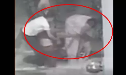 खतरनाक वीडियो वायरल, पालतू पिटबुल कुत्ते ने महिला पर किया हमला