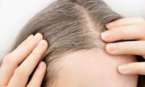 Hair Care Tips: आपके बालों की सभी समस्याओं को  खत्म कर देगा यह काला पानी