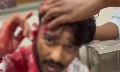 गणेश पंडाल के पास गुंडागर्दी, बदमाशों ने युवक को किया अधमरा गणेश पंडाल के पास गुंडागर्दी, बदमाशों ने युवक को किया अधमरा