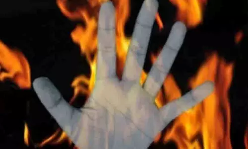 Angul: महिला ने आत्मदाह का प्रयास किया, गंभीर हालत में कटक स्थानांतरित Angul: महिला ने आत्मदाह का प्रयास किया, गंभीर हालत में कटक स्थानांतरित