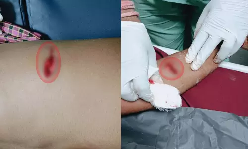 रावाभाटा में मां-बेटे पर बदमाशों का हमला, लूट की नीयत से चाकूबाजी, दोनों घायल रावाभाटा में मां-बेटे पर बदमाशों का हमला, लूट की नीयत से चाकूबाजी, दोनों घायल