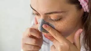 Skin care: नाक के आसपास की काली त्वचा से हैं परेशान, तो इससे छुटकारा पाने के लिए आजमाएं ये टिप्स Skin care: नाक के आसपास की काली त्वचा से हैं परेशान, तो इससे छुटकारा पाने के लिए आजमाएं ये टिप्स