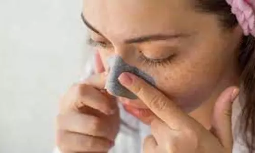Skin care: नाक के आसपास की काली त्वचा से हैं परेशान, तो इससे छुटकारा पाने के लिए आजमाएं ये टिप्स Skin care: नाक के आसपास की काली त्वचा से हैं परेशान, तो इससे छुटकारा पाने के लिए आजमाएं ये टिप्स