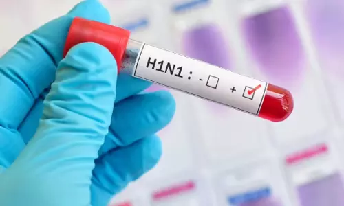 स्वाइन फ्लू से महिला की मौत, जिले में अलर्ट जारी