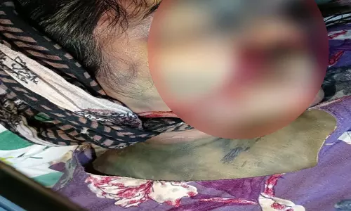 विवाहिता की संदिग्ध मौत पर कार्रवाई नहीं करने का मामला गरमाया, पुरानी बस्ती थाना पुलिस पर गंभीर आरोप