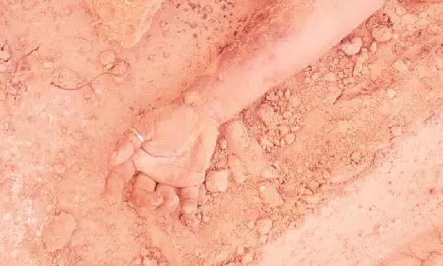 17 वर्षीय छात्रा का जला हुआ शव मिला, एक डायरी बरामद