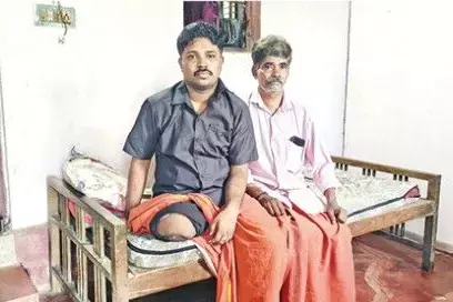 Thrissur में बाइक गड्ढे में फंसने से युवक का एक पैर कटा पुलिस ने बाइक सवार और उसके भाई पर मामला दर्ज Thrissur में बाइक गड्ढे में फंसने से युवक का एक पैर कटा पुलिस ने बाइक सवार और उसके भाई पर मामला दर्ज