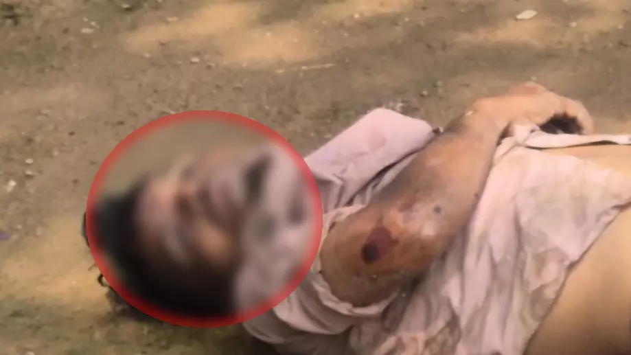 रायपुर में युवक की लाश मिलने से सनसनी, कार से टकराकर हुआ था घायल रायपुर में युवक की लाश मिलने से सनसनी, कार से टकराकर हुआ था घायल