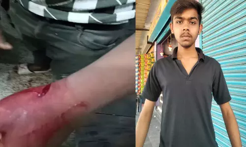 रायपुर में चाकूबाजी: नशे में गुपचुप वाले से पैसे मांगकर किया प्राणघातक हमला रायपुर में चाकूबाजी: नशे में गुपचुप वाले से पैसे मांगकर किया प्राणघातक हमला