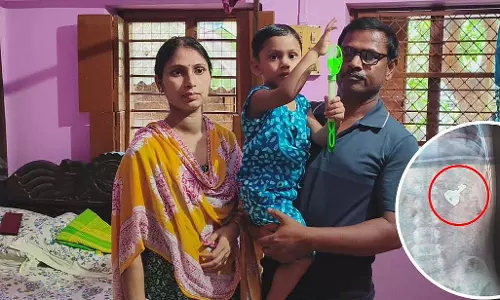 नन्हे अनीक ने निगल ली लोहे की चाबी, माता-पिता चिंतित नन्हे अनीक ने निगल ली लोहे की चाबी, माता-पिता चिंतित