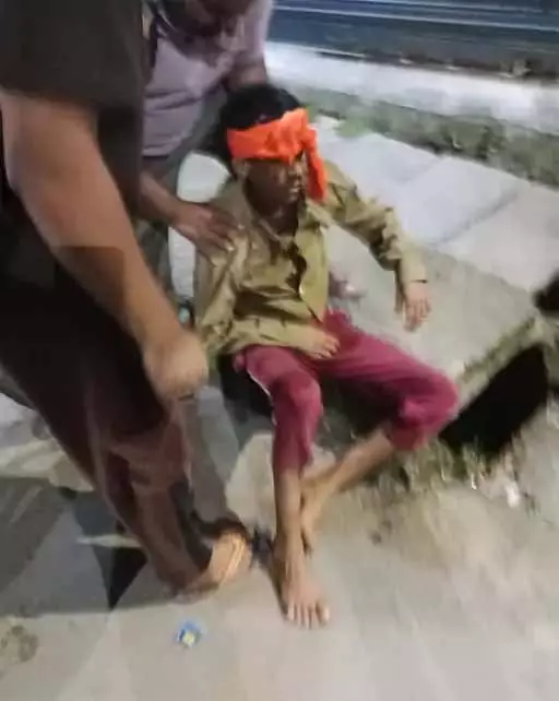 बाइक ने मारी ठोकर, 2 युवक ICU में एडमिट बाइक ने मारी ठोकर, 2 युवक ICU में एडमिट
