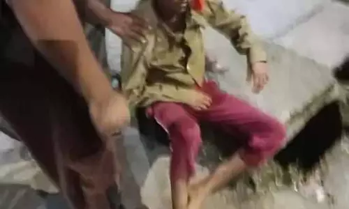 बाइक ने मारी ठोकर, 2 युवक ICU में एडमिट